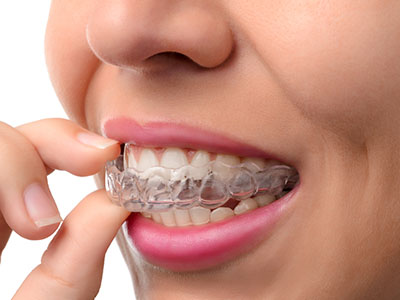 Phoenix Dental | Emergency Treatment, Root Canals and Wisdom Teeth Extractions