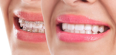 Phoenix Dental | ClearCorrect reg , Oral Exams and Invisalign reg 