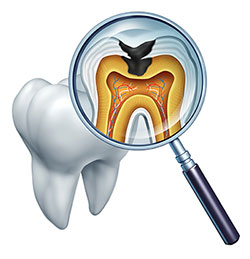 Phoenix Dental | Dentures, Dental Fillings and Internal Bleaching