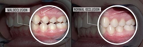 Phoenix Dental | Cosmetic Dentistry, Emergency Treatment and Internal Bleaching