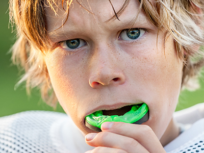 Phoenix Dental | Sports Mouthguards, Intraoral Camera and Root Canals